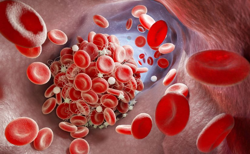 [VOD AVAILABLE] Optical Method-Derived Clot Curve: Introduction and Basic Applications